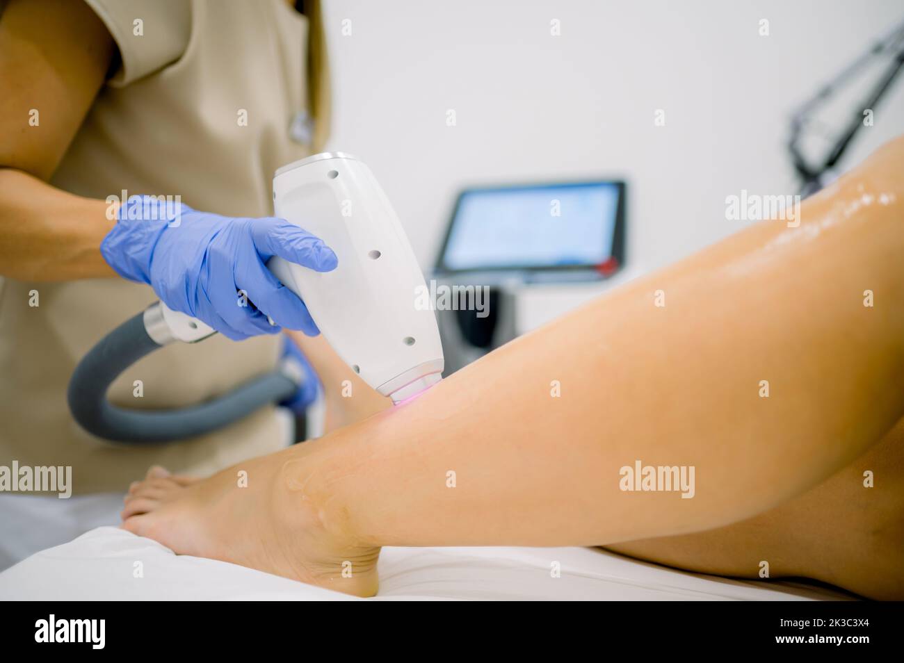 Crop specialist removing leg hair with laser Stock Photo