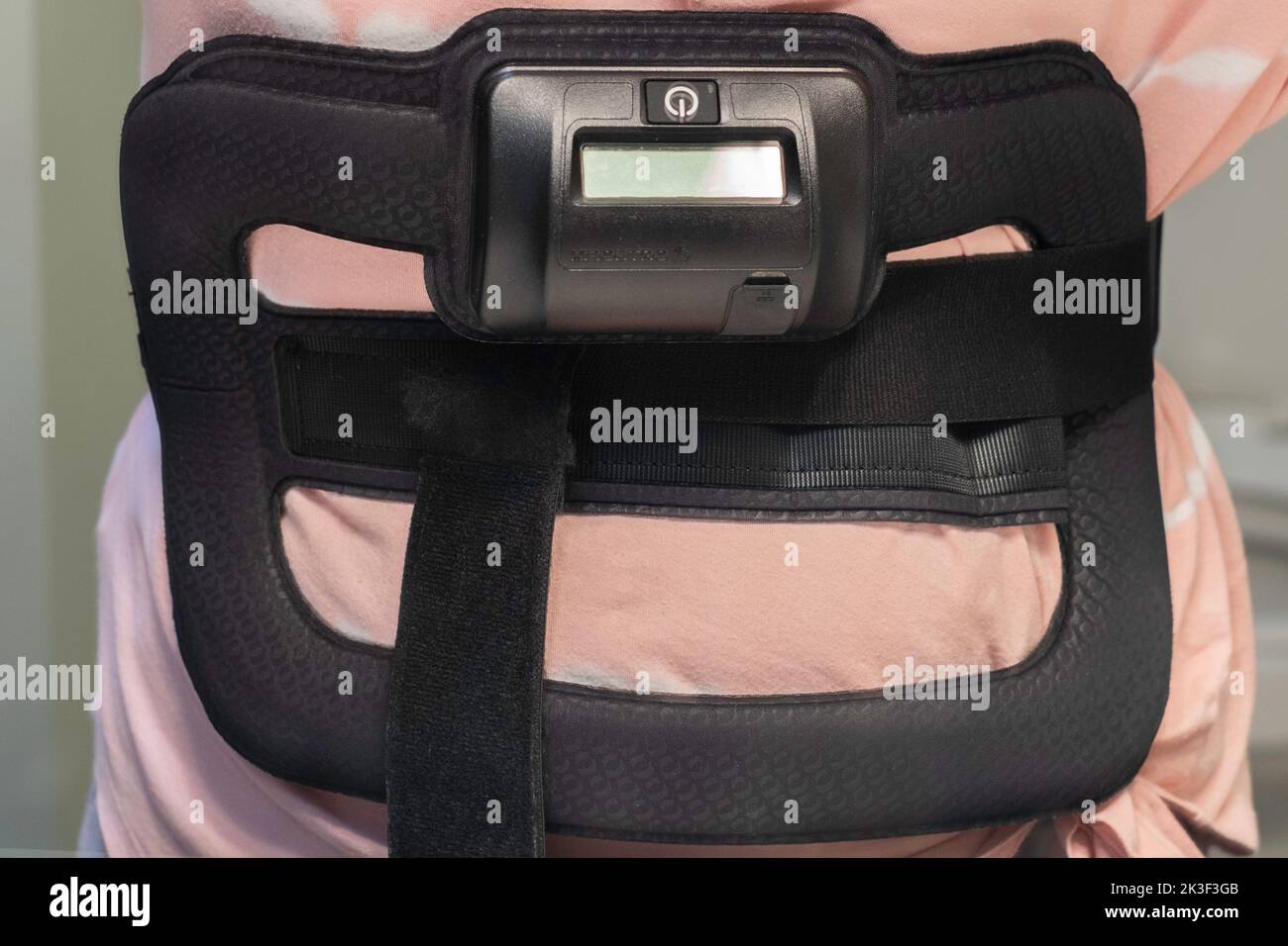 The torso of a woman wearing an Orthofix bone stimulator to aid in bone healing after major back surgery. USA. Stock Photo