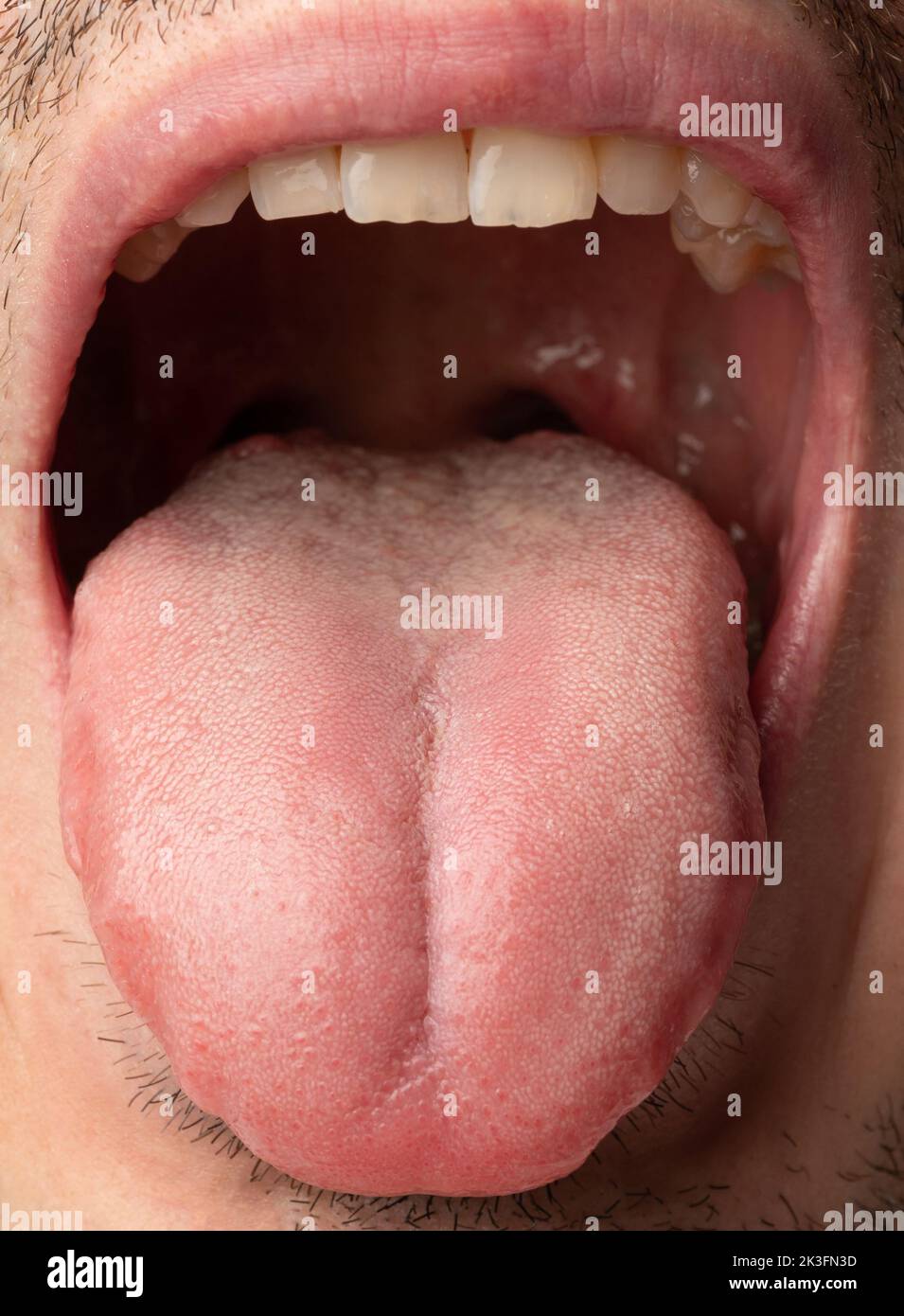Man with mouth open tongue hi-res stock photography and images - Alamy