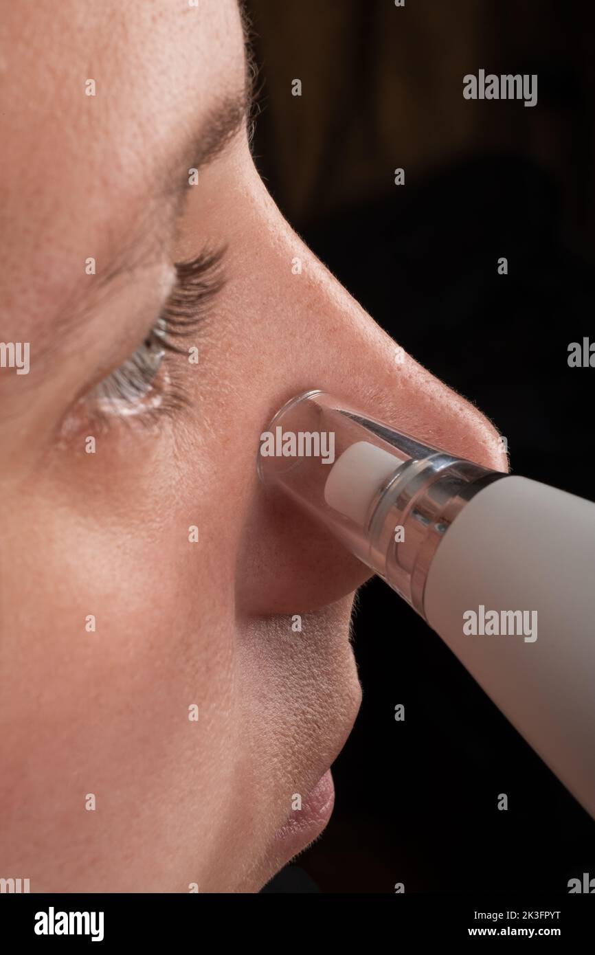 woman with vacuum face pore cleaner, skin care. Stock Photo