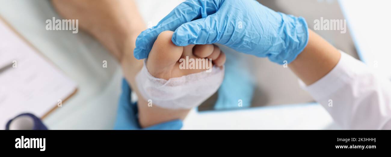 Doctor diagnoses pain and calluses on soles of feet Stock Photo Alamy