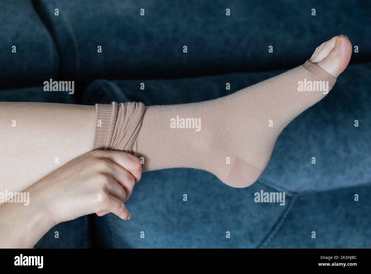 Girl's legs in compression stockings for varicose veins. Pregnancy and