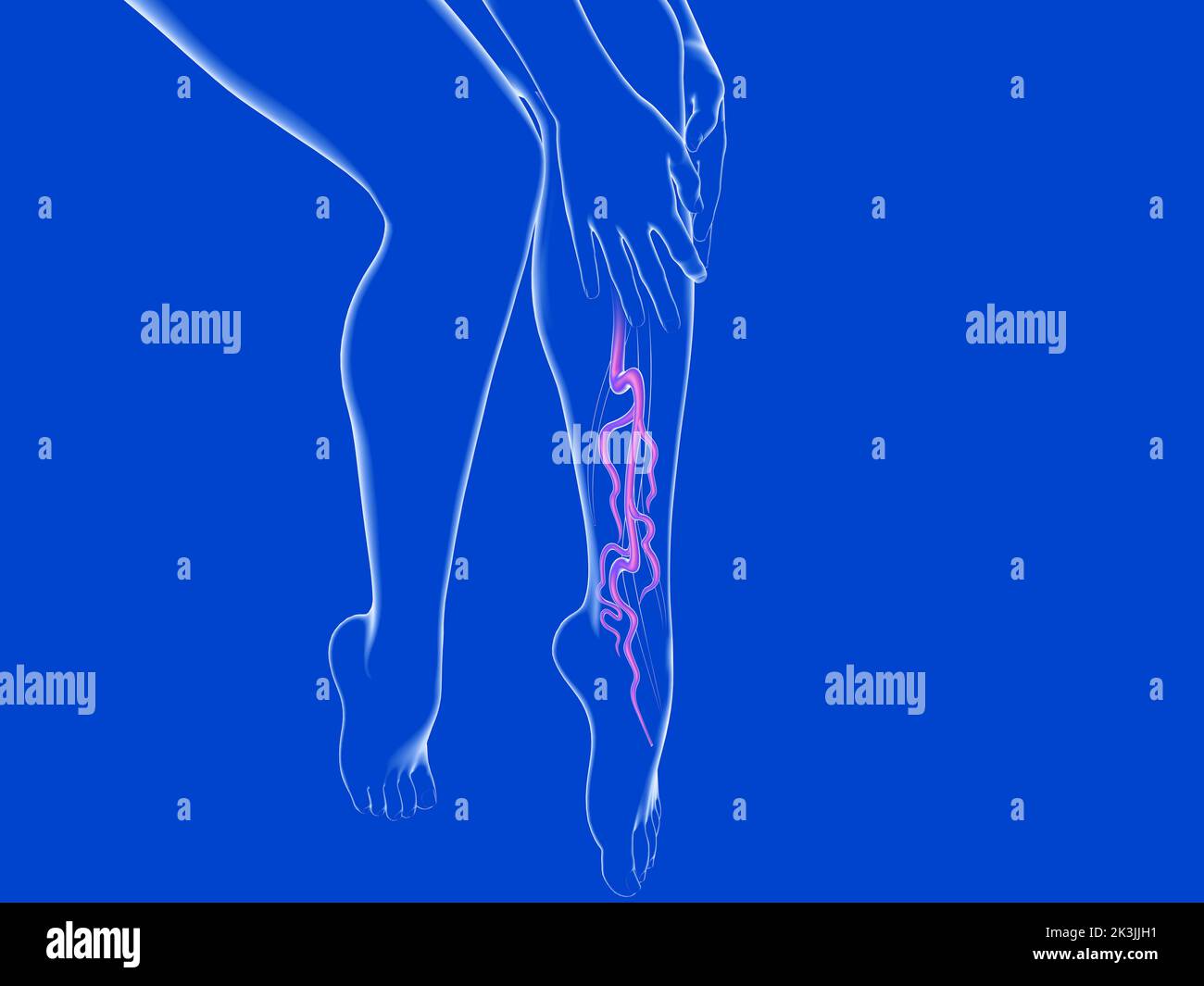 3d illustration of the varicose vein system. Transparent glass anatomy of female legs Stock