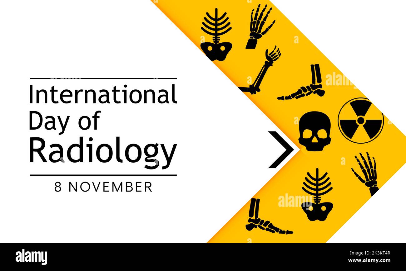 World radiography day hires stock photography and images Alamy