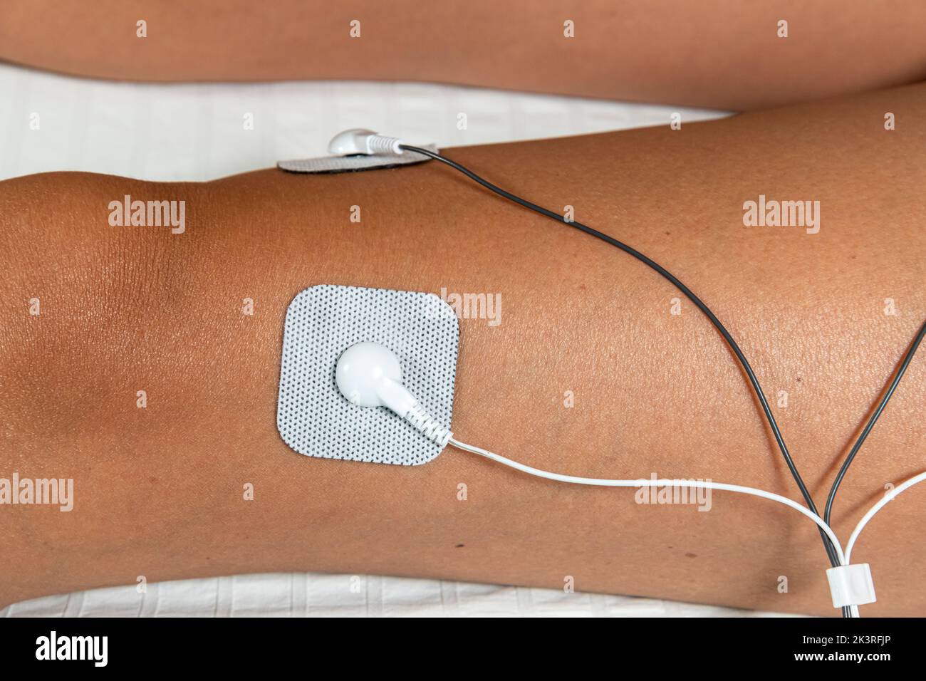 https://c8.alamy.com/comp/2K3RFJP/self-adhesive-electrode-pad-of-tens-transcutaneous-electrical-nerve-stimulation-and-ems-electronic-muscle-stimulation-unit-therapy-machine-2K3RFJP.jpg