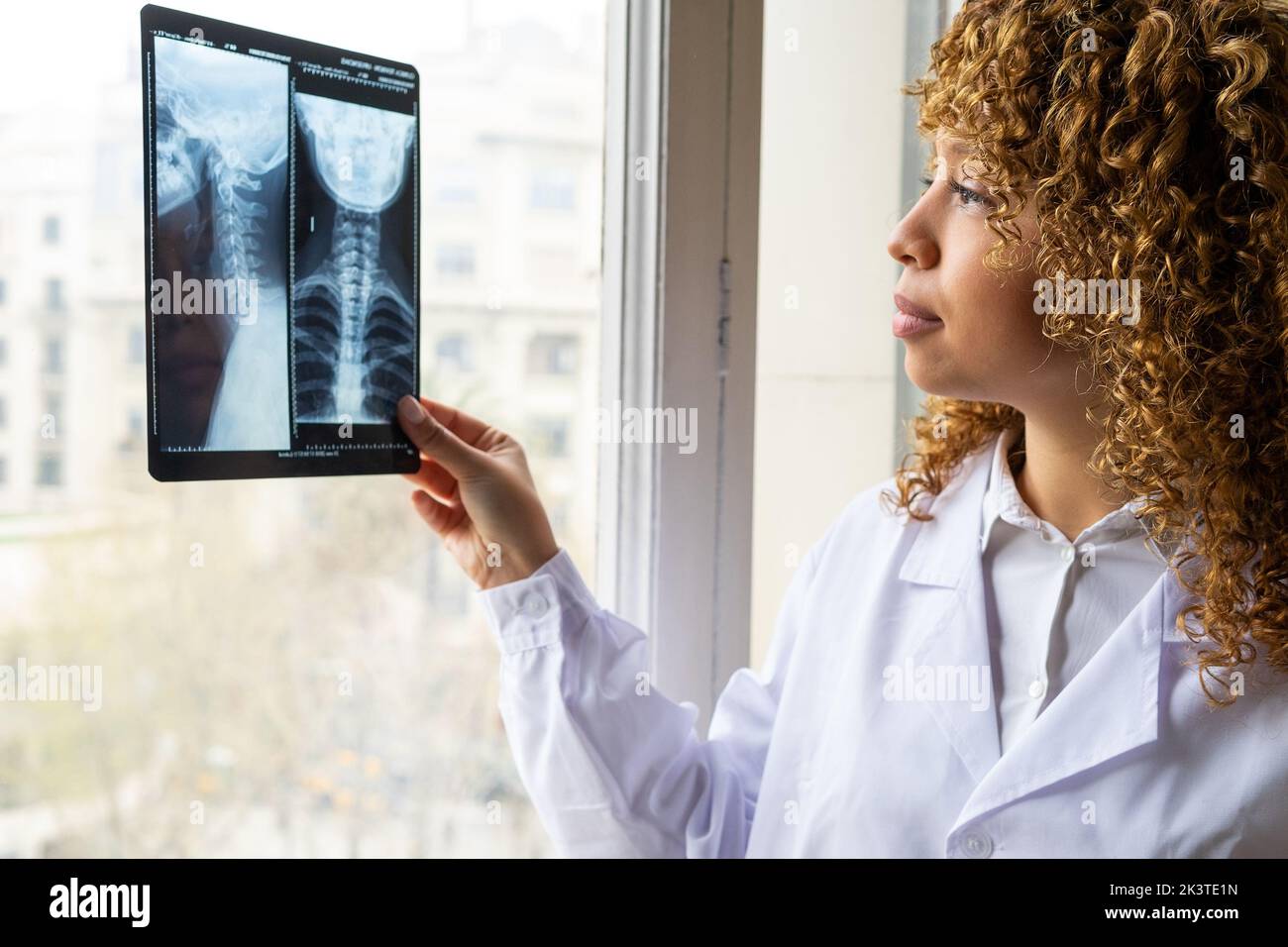 Crop ethnic female medic in uniform studying X ray image of spine on window in office Stock Photo