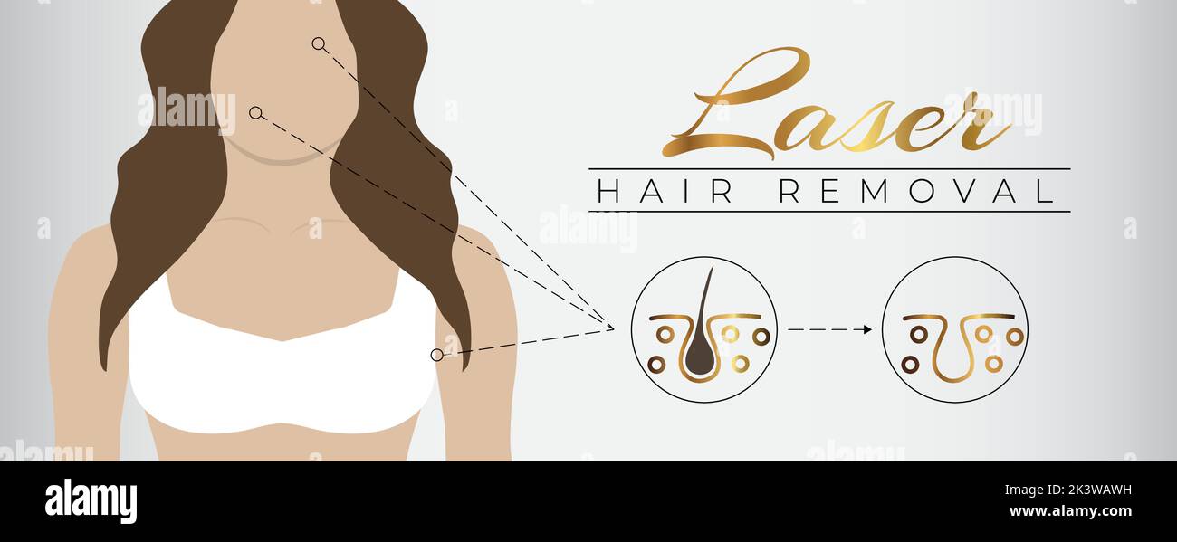 Laser Hair Removal Treatment Illustration Design for Face Permanent