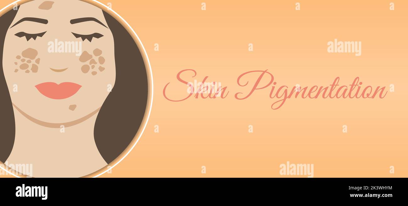 Skin Pigmentation Background Illustration Design. Orange Banner with Woman Face Stock Vector