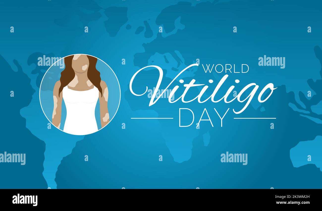 World Vitiligo Day Blue Background Design Stock Vector Image & Art Alamy