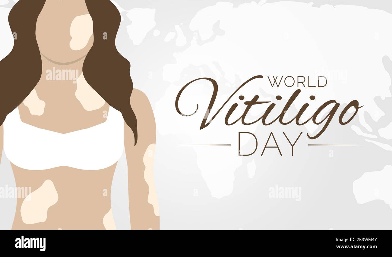 World Vitiligo Day Background Illustration Stock Vector Image & Art Alamy