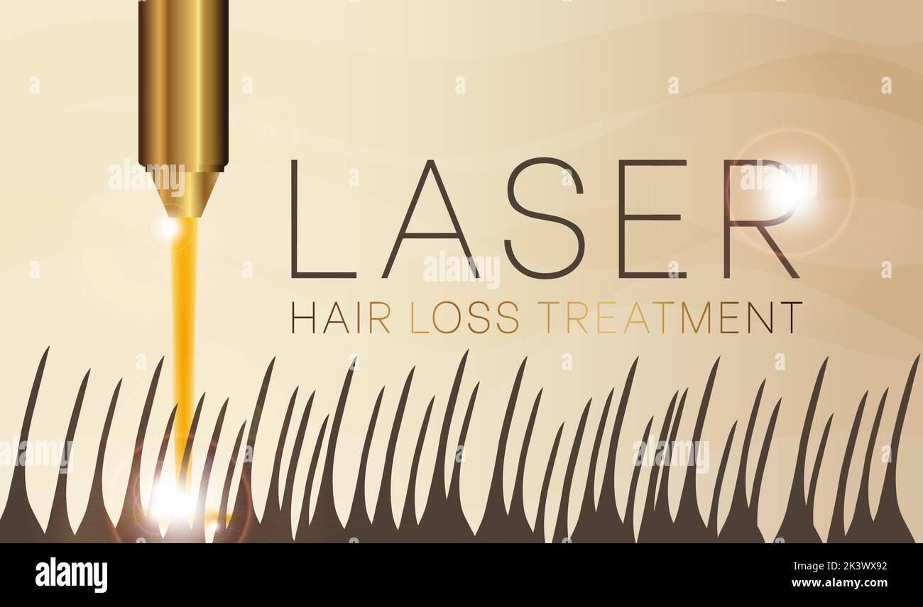 Laser Hair Loss Treatment Background Illustration Stock Vector