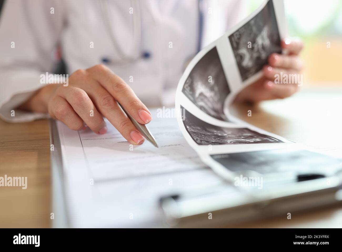 Gynecologist examines results of examination of uterus Stock Photo