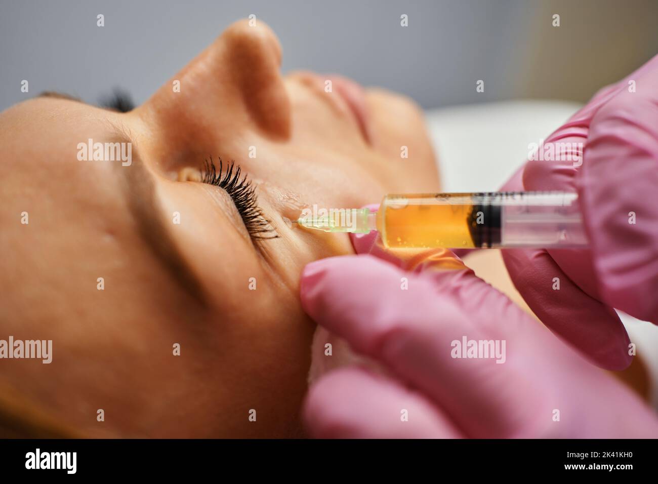 Blood plasma injections in the eye area Stock Photo Alamy