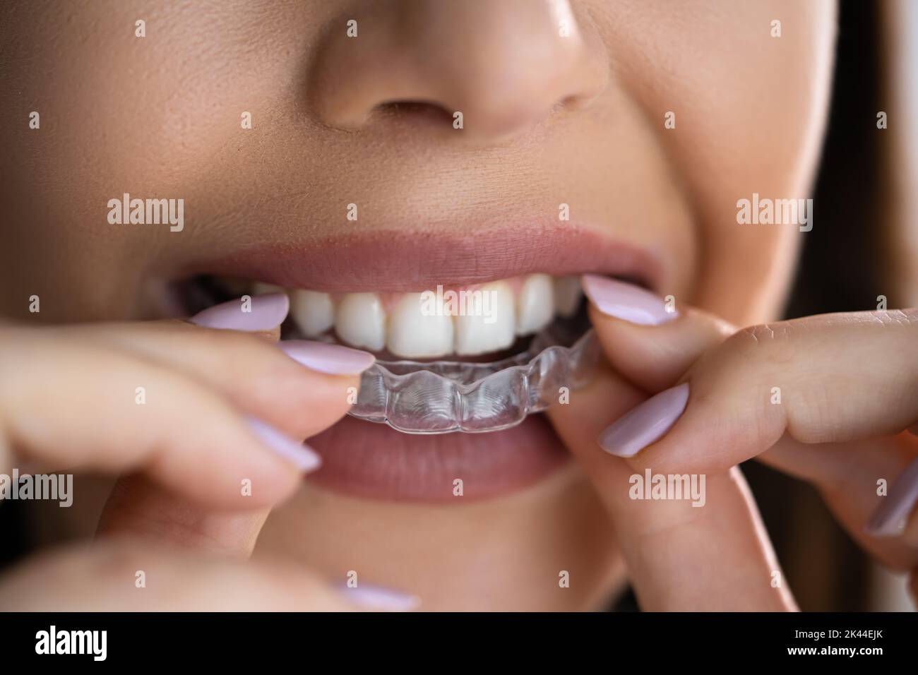 Clear Aligner Dental Night Guard For Teeth Stock Photo