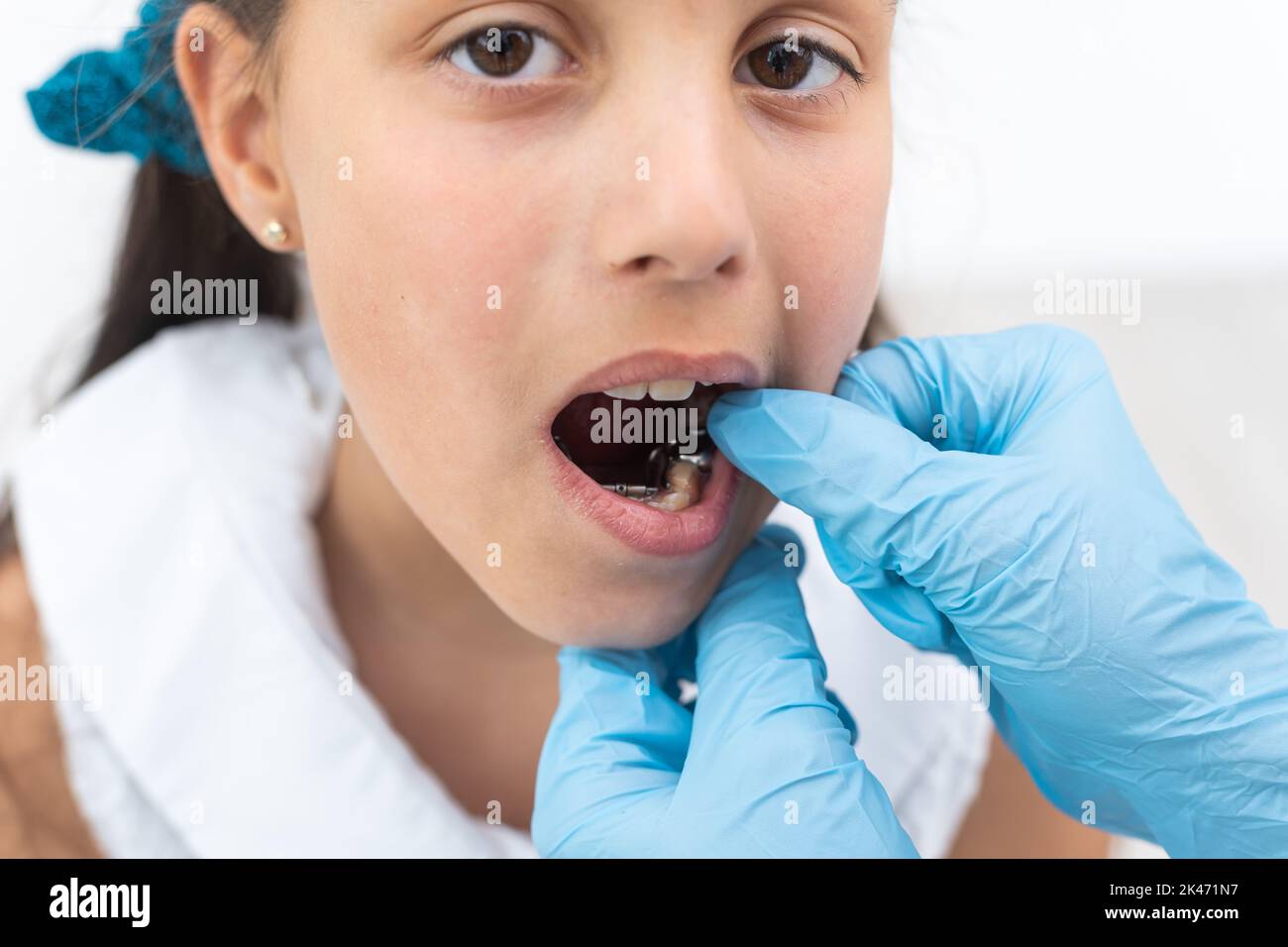 Dentist is check and set dimension of brackets. Talking to girl about