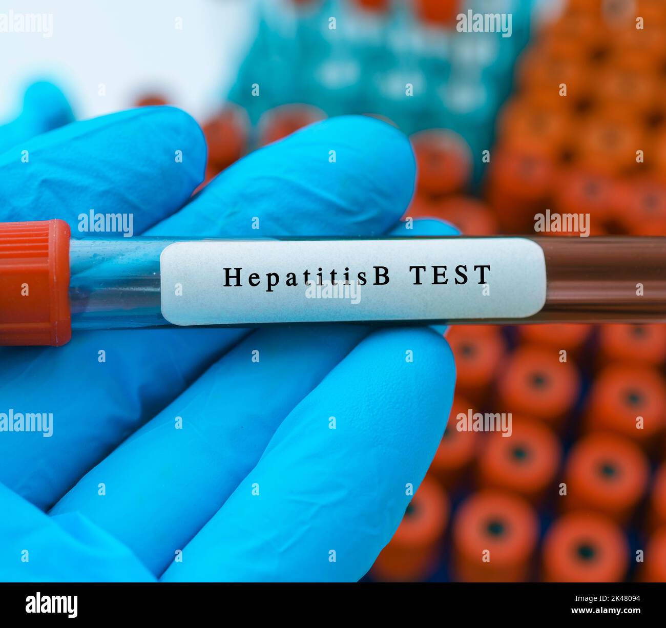 Hepatitis B Virus Blood Test, Conceptual Image Stock Photo - Alamy