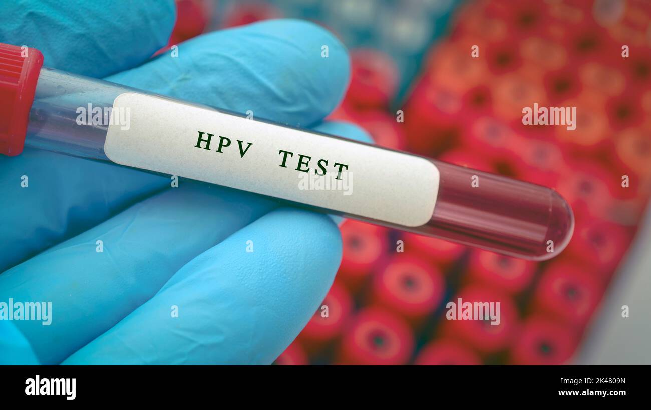 HPV blood test, conceptual image Stock Photo Alamy