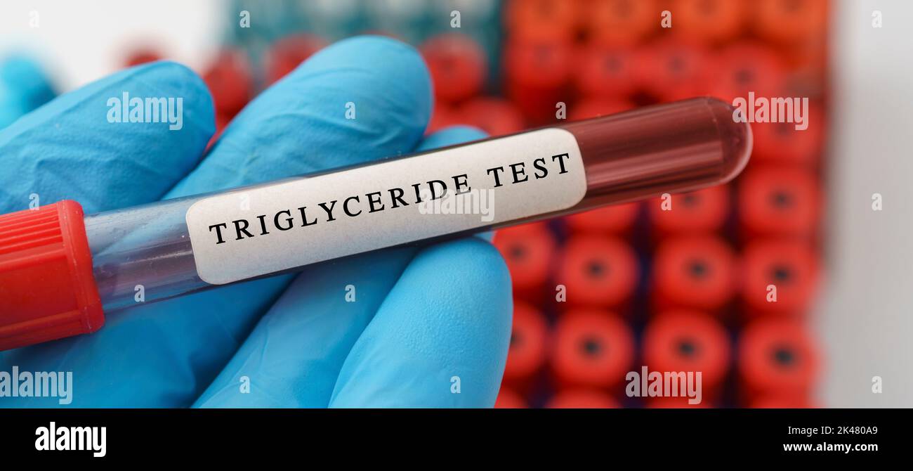 Triglyceride blood test, conceptual image Stock Photo Alamy