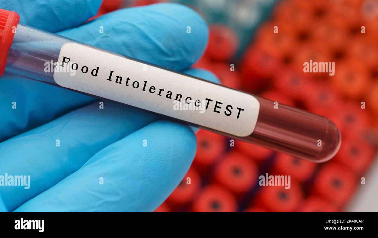 Food intolerance blood test, conceptual image Stock Photo Alamy
