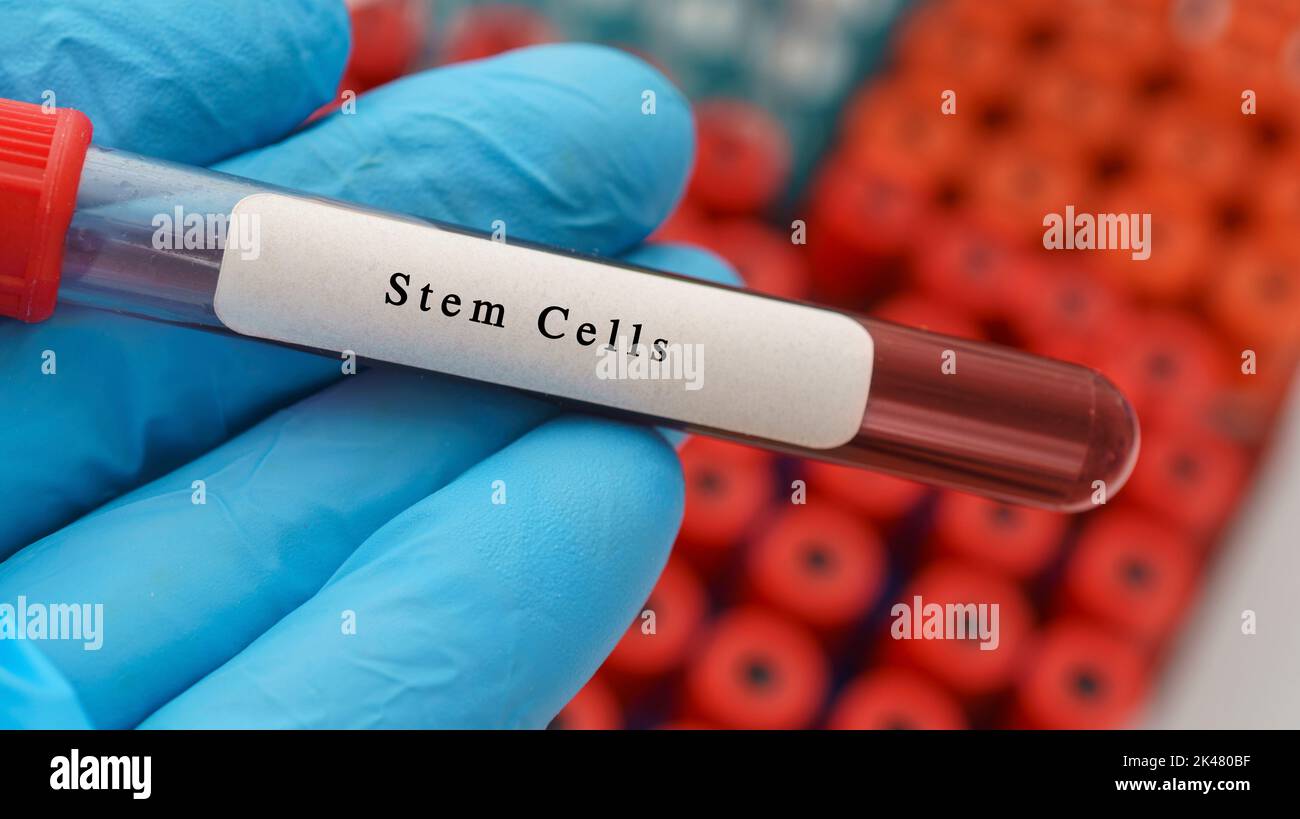 Stem cells sample, conceptual image Stock Photo - Alamy