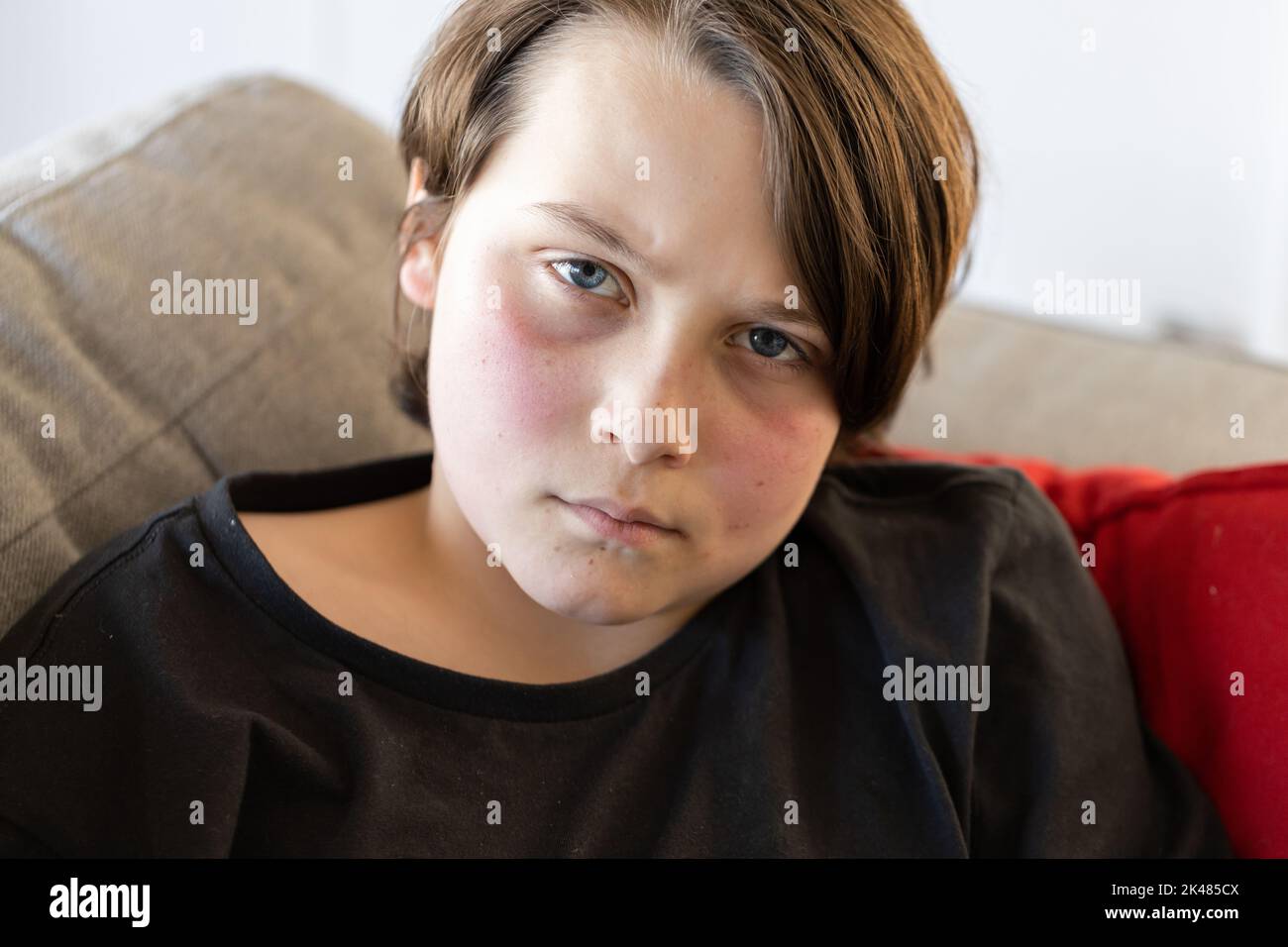 An unwell preteen boy lying on a couch looking at the camera, his cheeks are red from a fever and he looks miserable Stock Photo