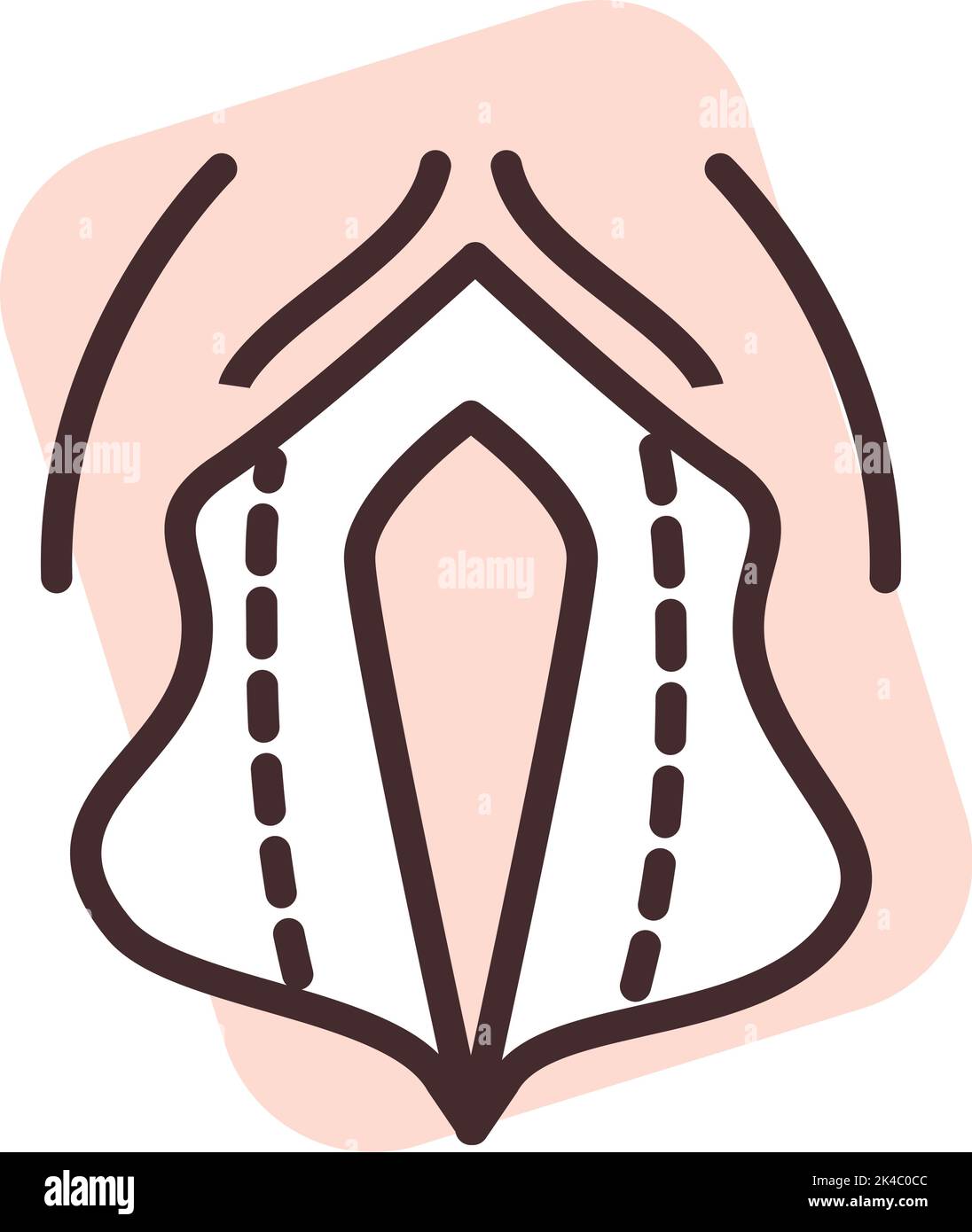 Ginecological surgery, illustration, vector on white background. Stock Vector