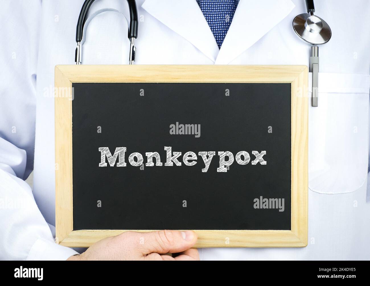 Doctor holding chalkboard with Monkeypox message Stock Photo