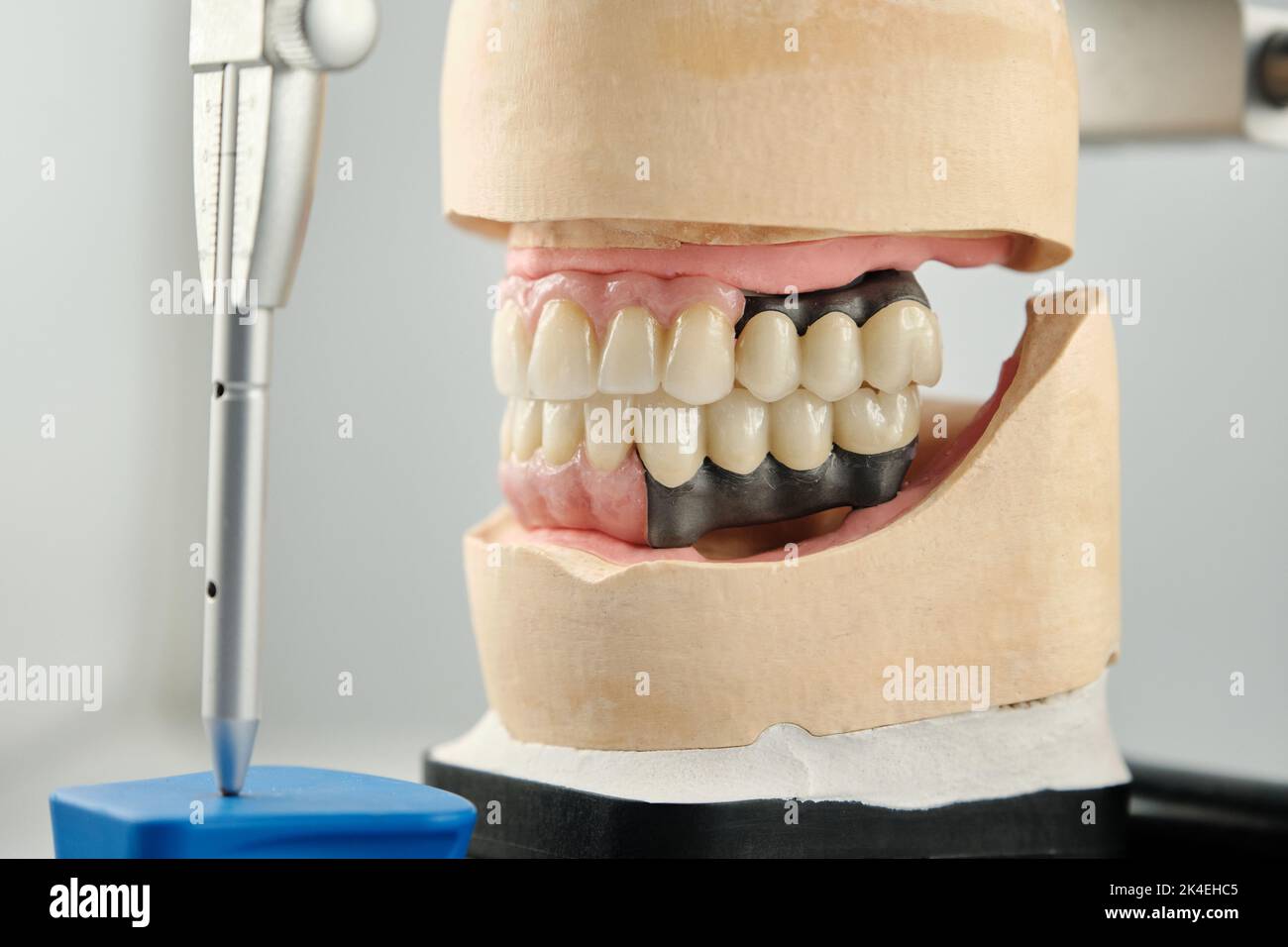 Dental photo of the articulator and two dental prostheses in the