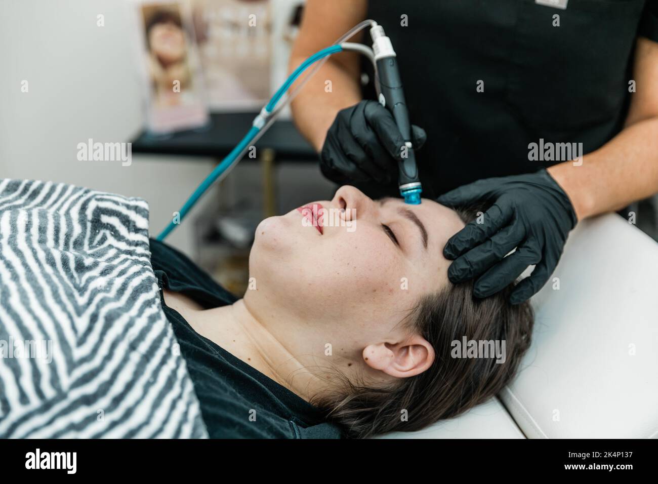 A healthcare provider giving a patient client a non-invasive resurfacing treatment facial for cleansing, extraction, exfoliating, and hydration Stock Photo