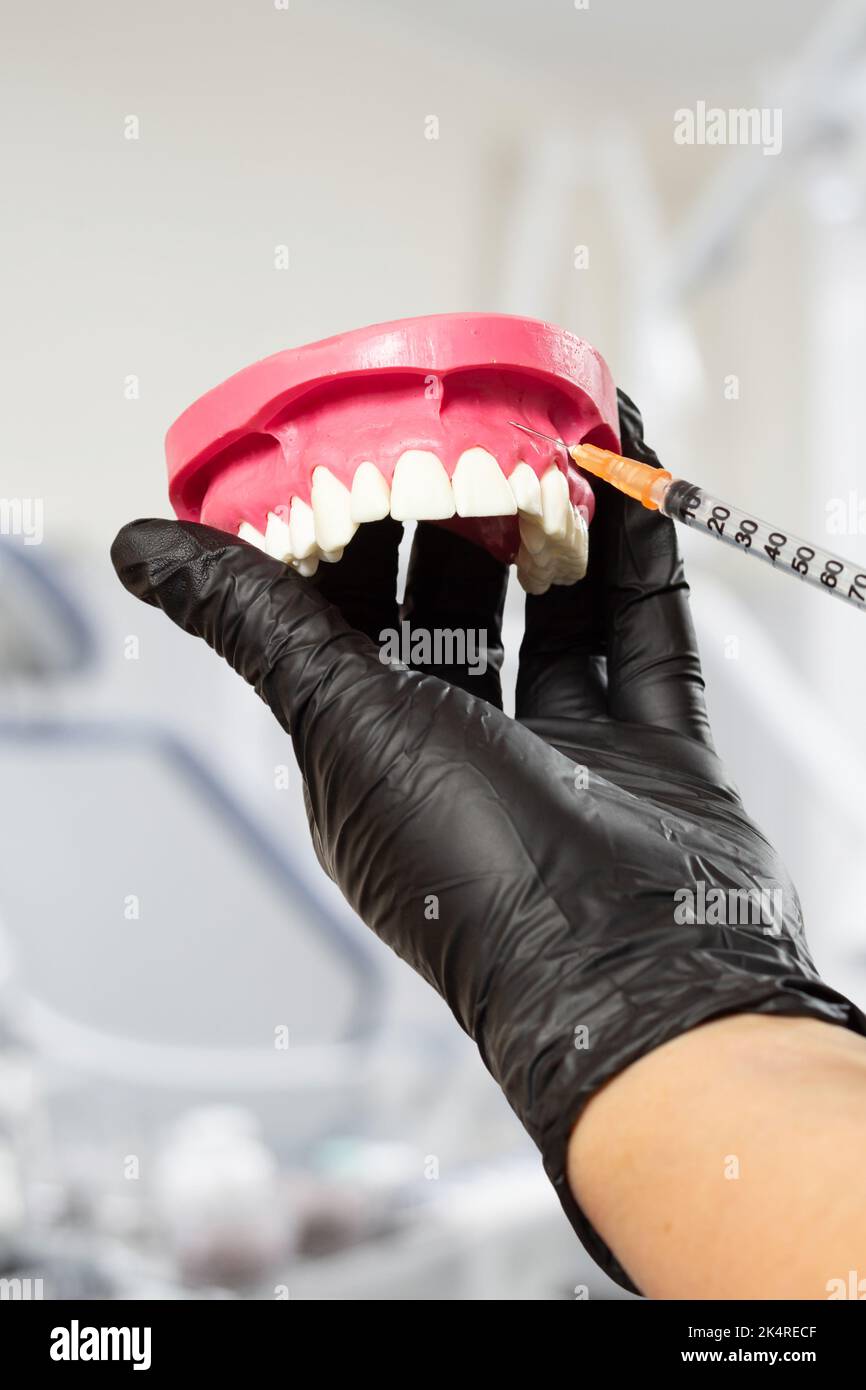 Dentist's hand holding a layout of the human jaw and a syringe with