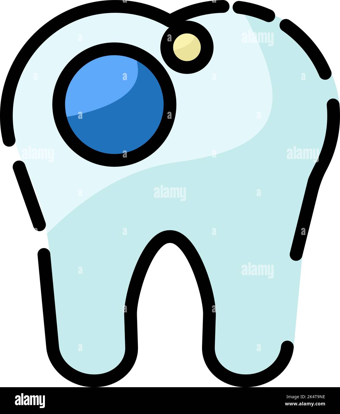 Dental caries, illustration, vector on a white background. Stock Vector