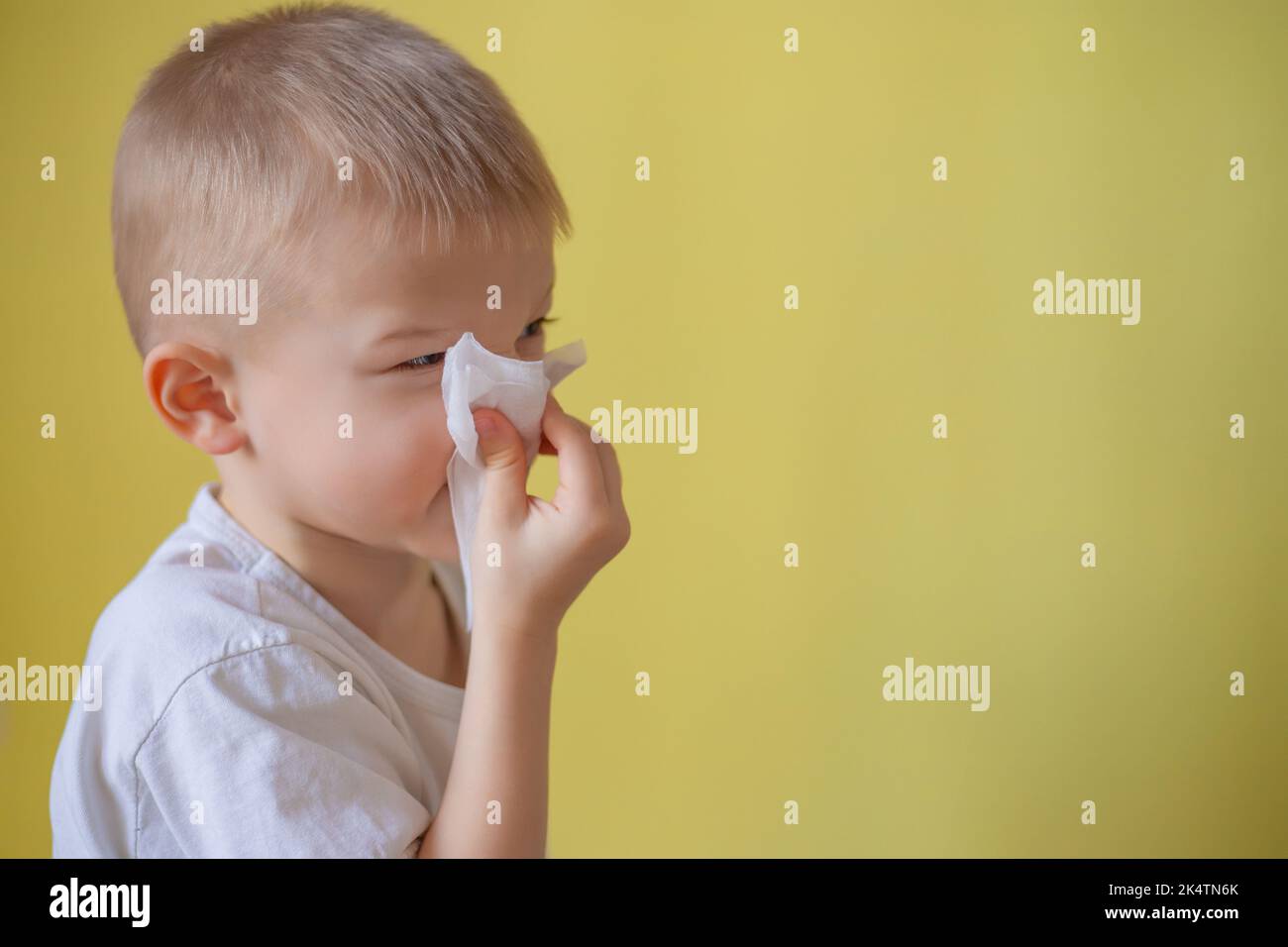 A child in a white T-shirt on a yellow background, blowing his nose. Sick child with napkin. Allergic kid, flu season. Kid with cold rhinitis, cold. L Stock Photo
