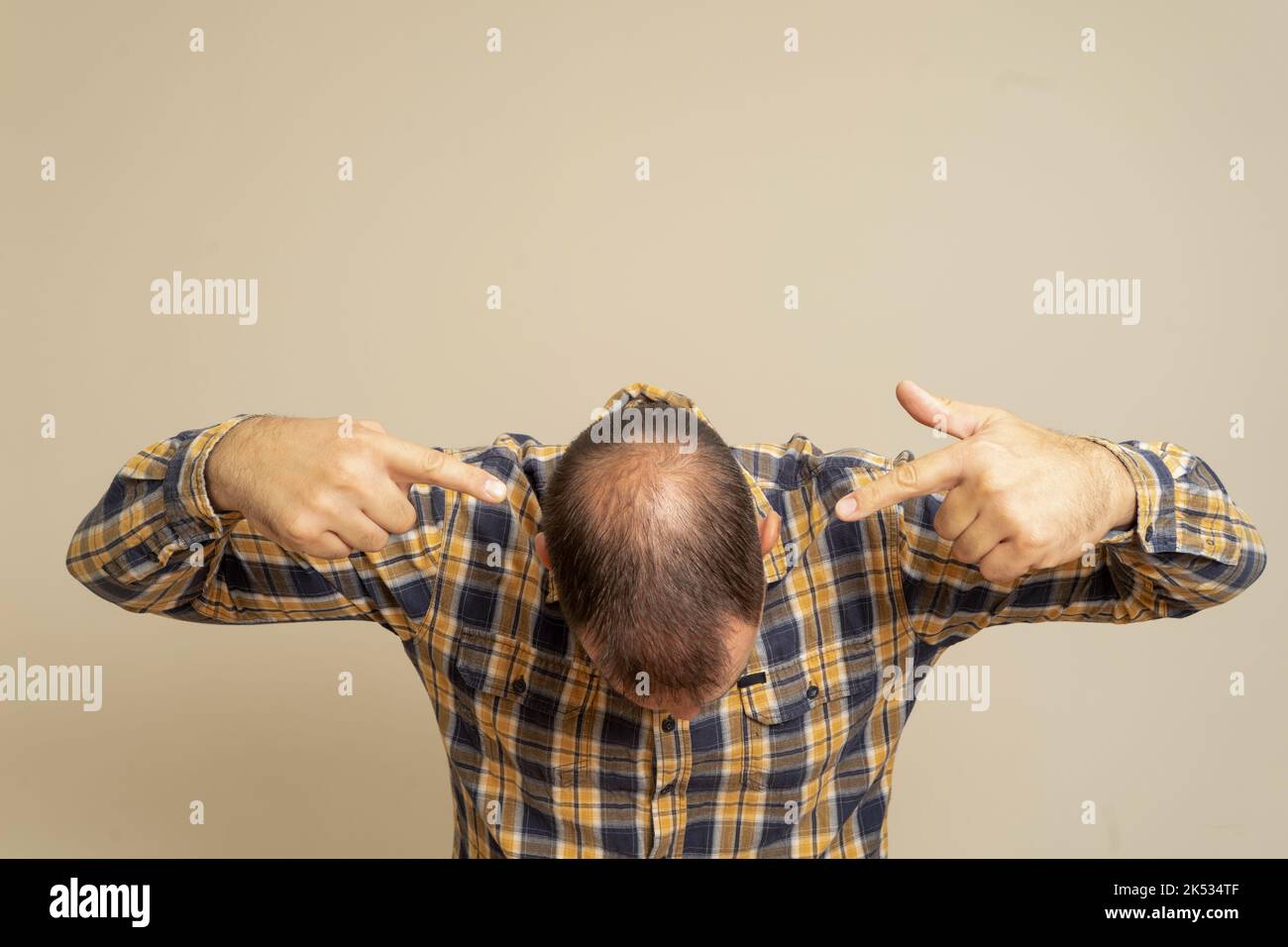 Man pointing at his incipient alopecia with both hands, wears a checked shirt isolated on beige background. Stock Photo
