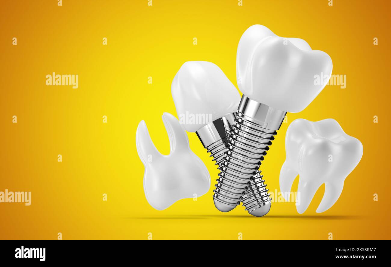 3d model illustration on yellow hi-res stock photography and images - Alamy