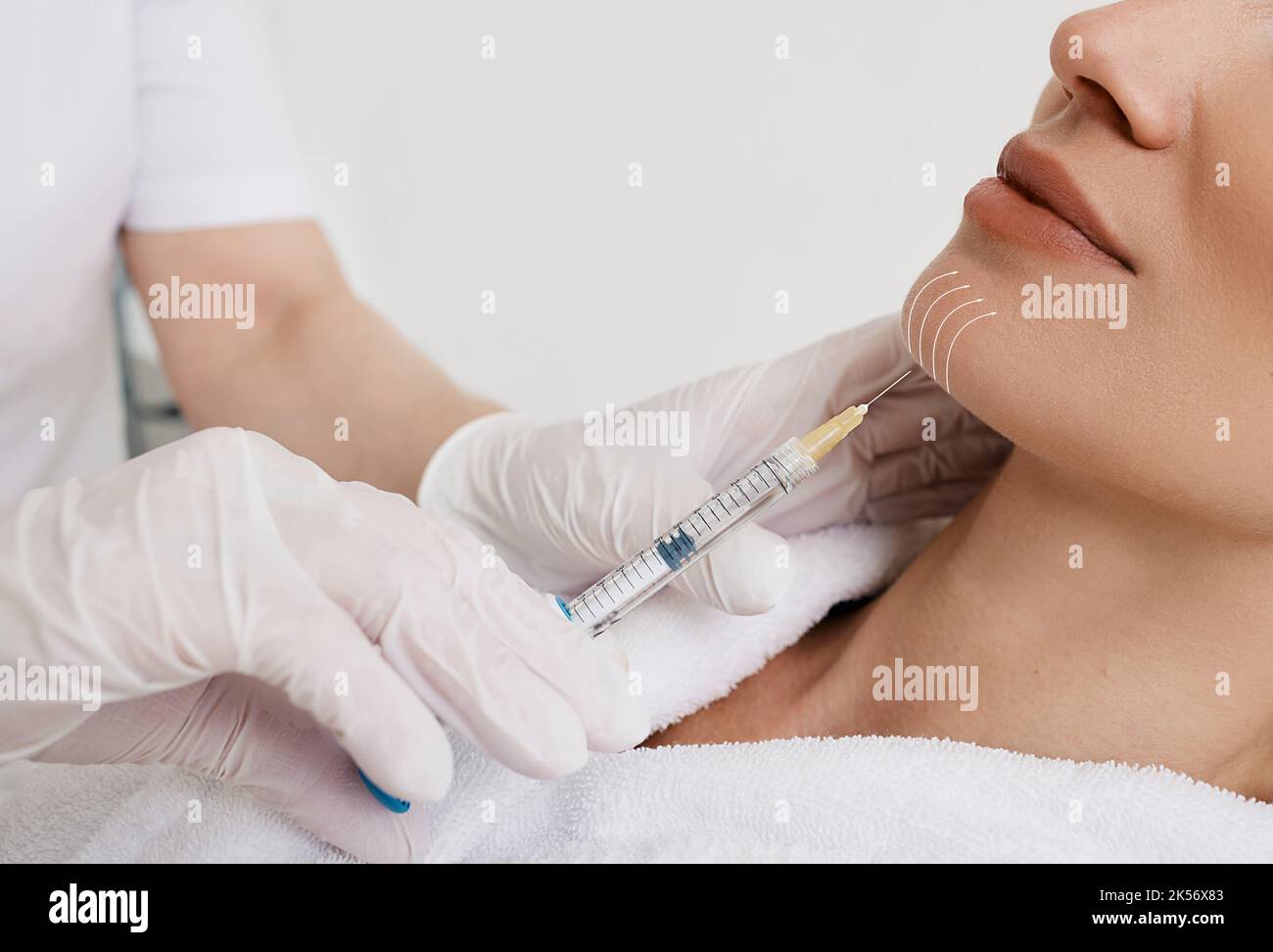 Facelift woman chin and lower face using beauty injection, non surgery. Process lifting face contour at cosmetology, close-up Stock Photo