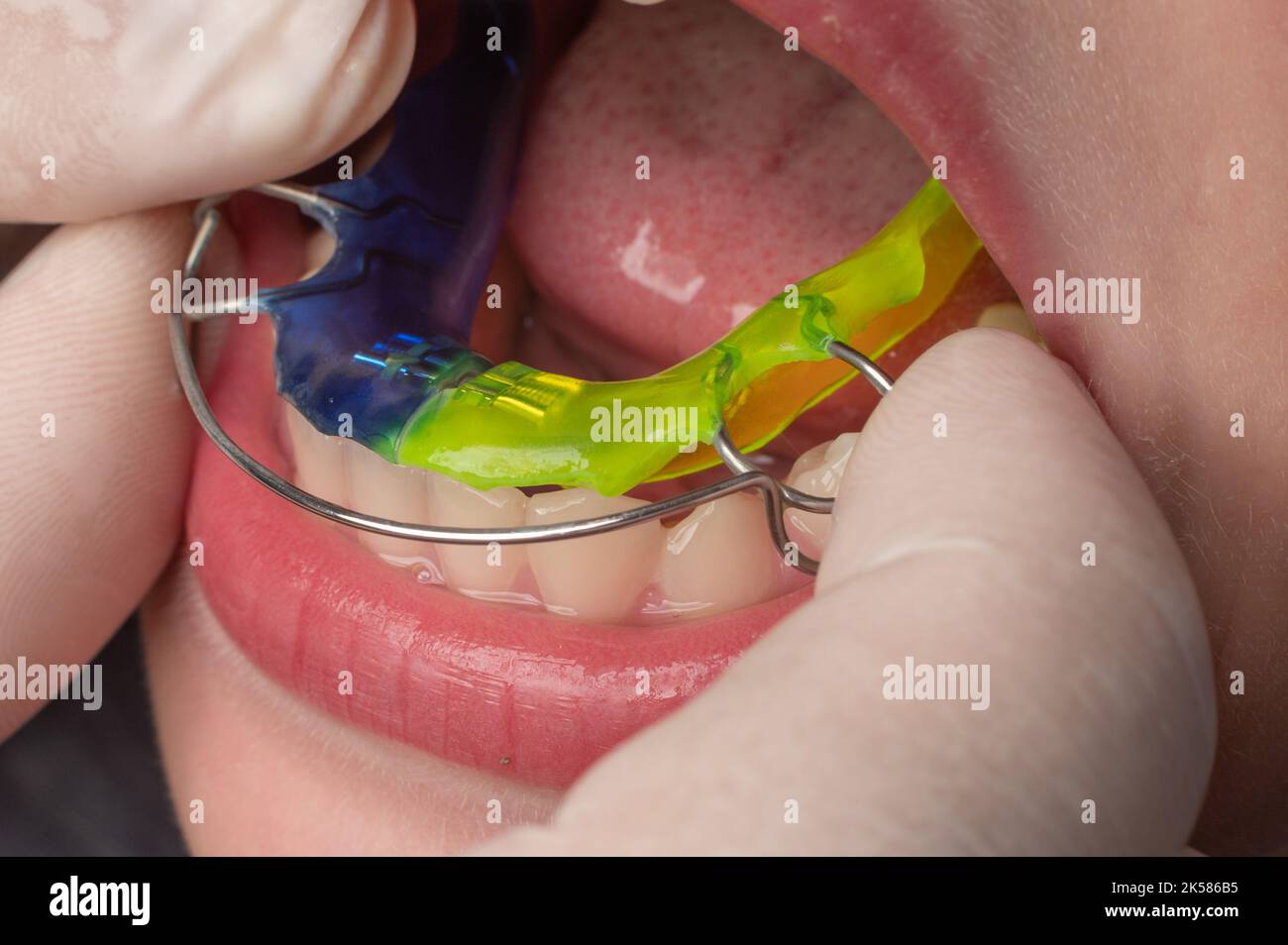 Yellow braces hi-res stock photography and images - Page 13 - Alamy