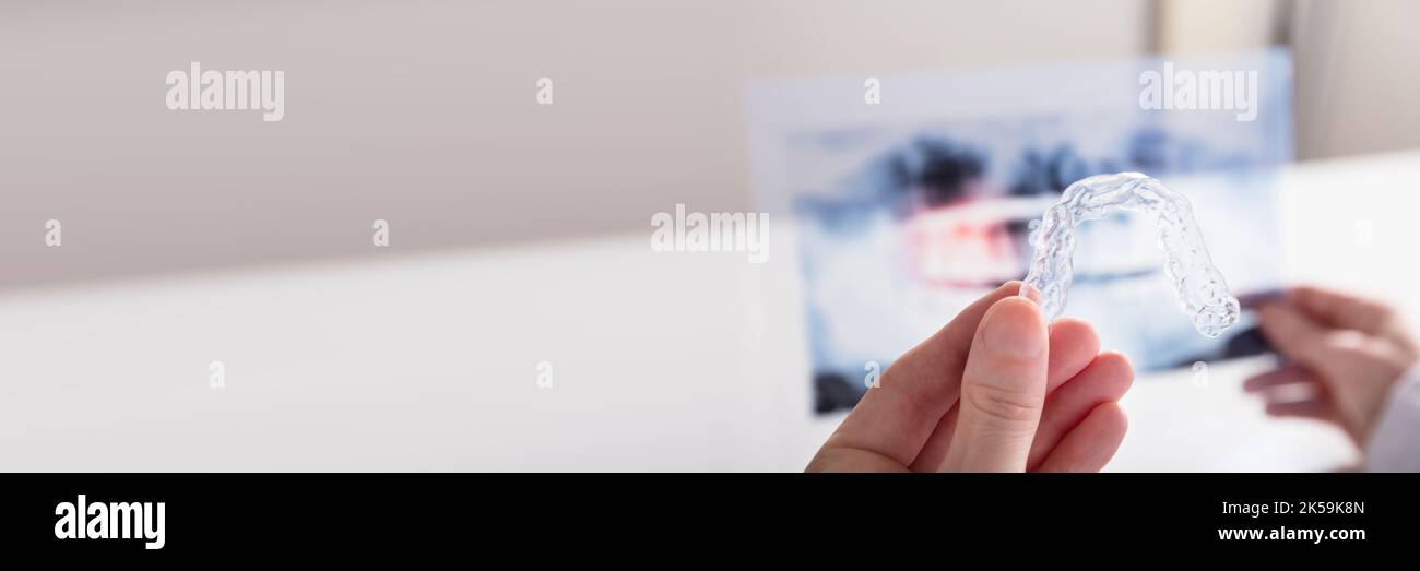 Wisdom Teeth Dental X Ray. Dentist Radiologist Doctor Stock Photo Alamy