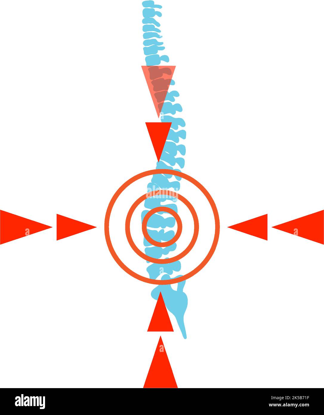 Red spot on spine illustration Stock Vector Image & Art - Alamy