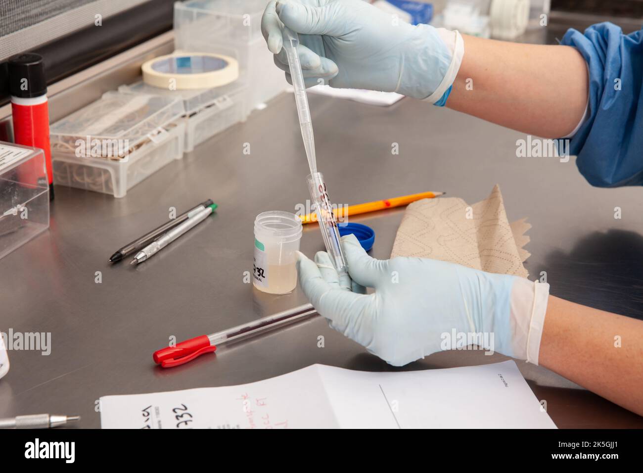 Scientist preparing a peritoneal fluid sample for cytology analysis in the laboratory. Cancer diagnosis concept. Medical concept. Stock Photo