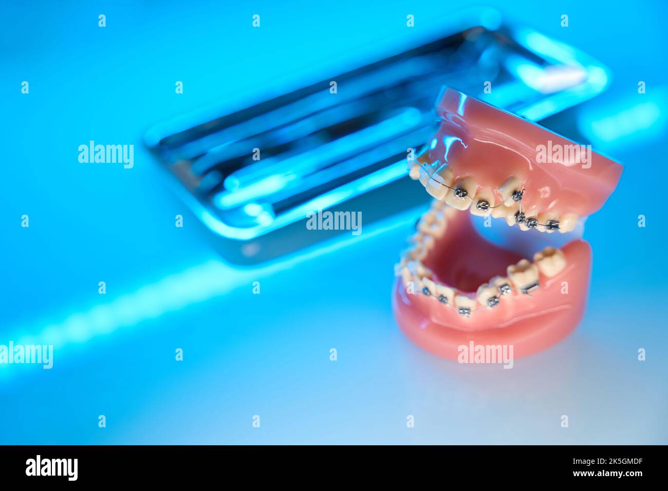 Orthodontic tools for teeth alignment. Jaw with braces Stock Photo Alamy
