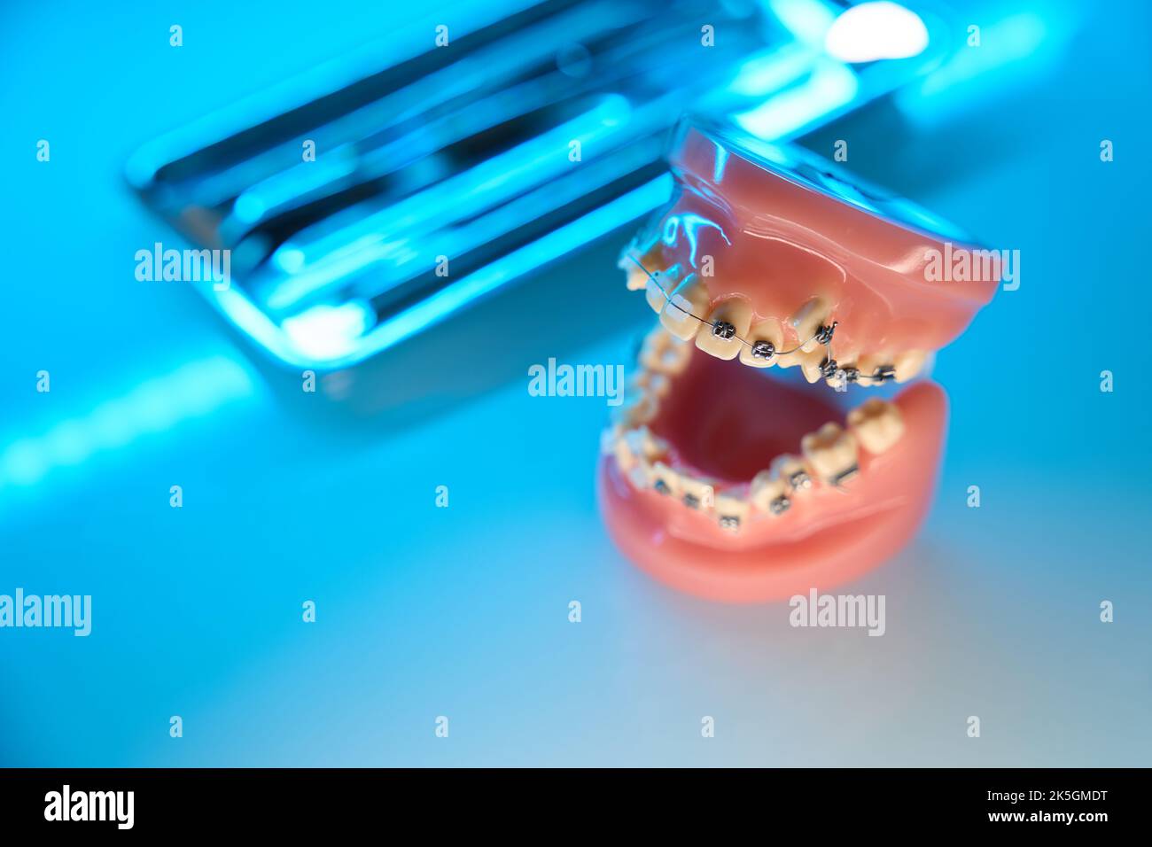 Open jaw with braces on teeth. Orthodontist set Stock Photo Alamy