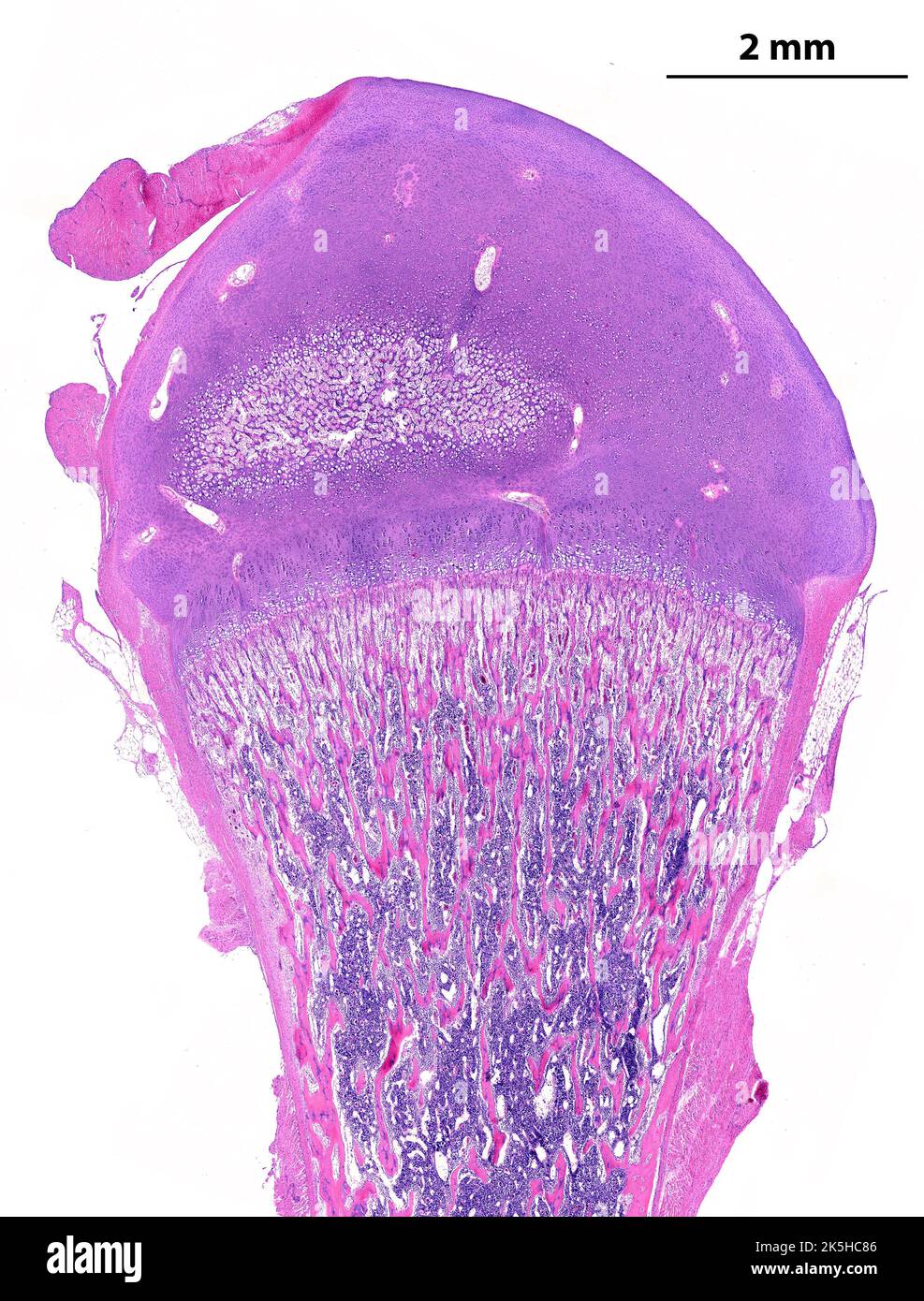 Low power light microscope micrograph showing a developing long bone (femur). On top, the epiphysis is made by hyaline cartilage that shows an initial Stock Photo