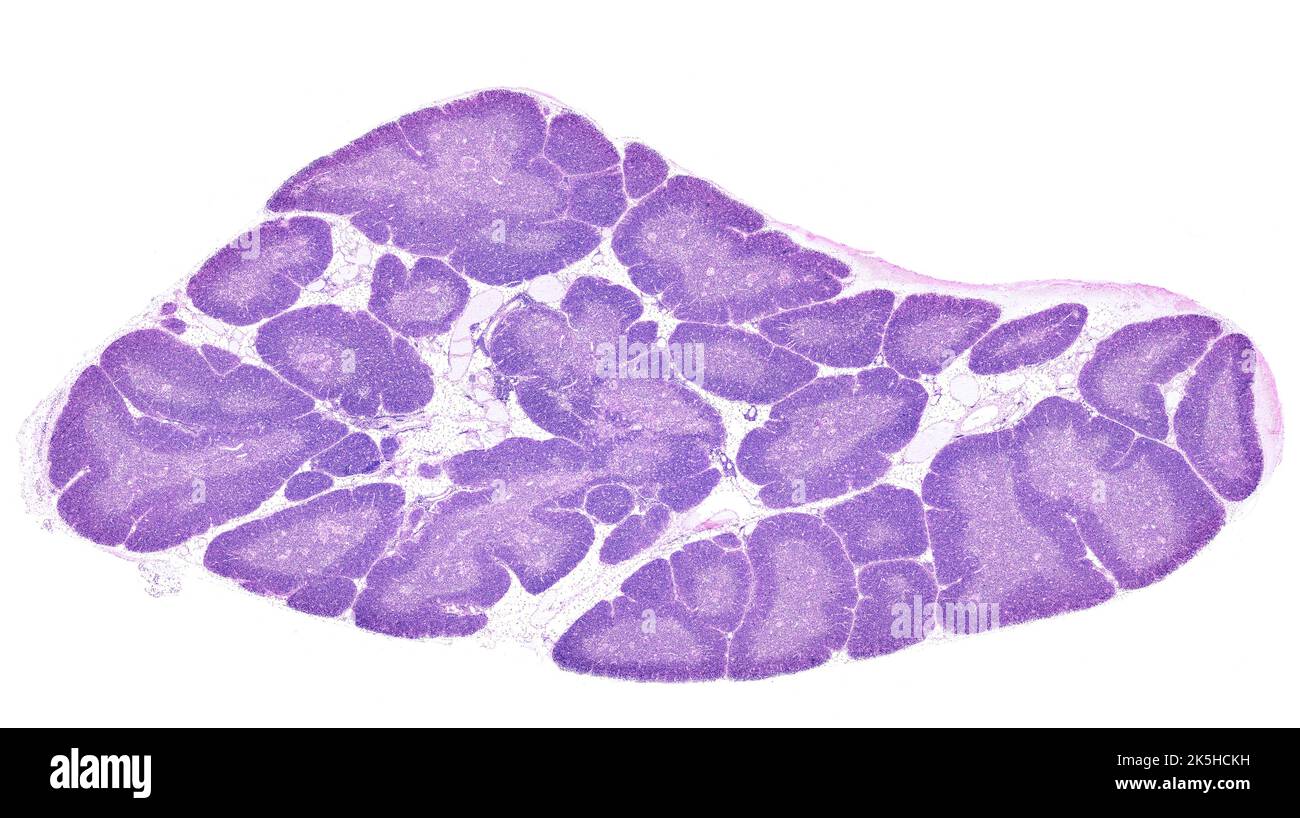 Low power light microscope micrograph of a human thymus gland stained with HE. The thymic parenchyma is composed of lobules separated by adipose tissu Stock Photo