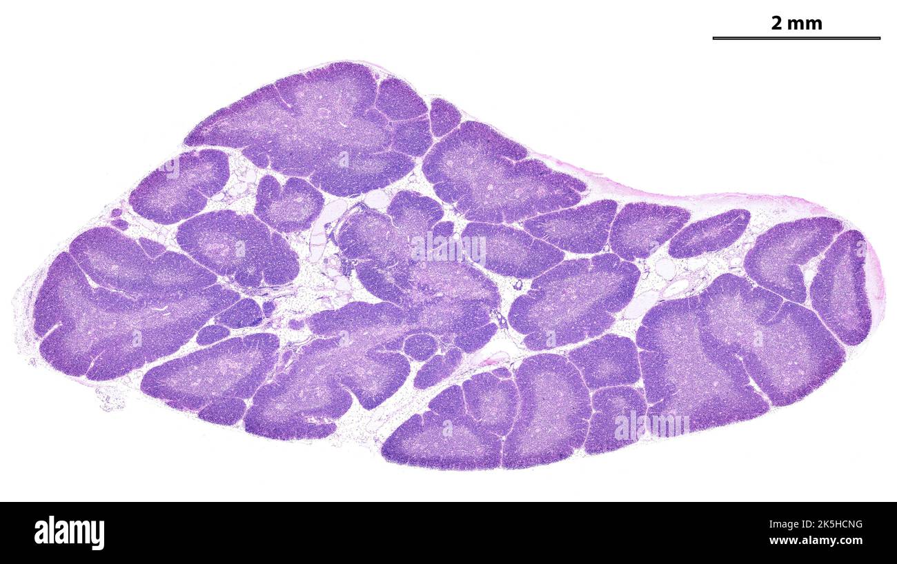 Low power light microscope micrograph of a human thymus gland stained with HE. The thymic parenchyma is composed of small lobules separated by adipose Stock Photo