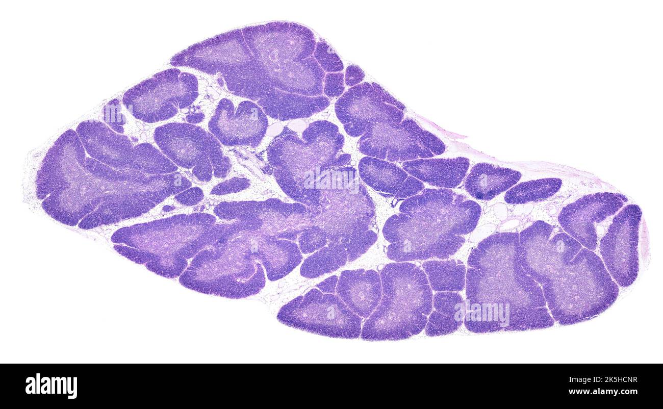 Low power light microscope micrograph of a human thymus gland stained with HE. The thymic parenchyma is composed of lobules separated by adipose tissu Stock Photo