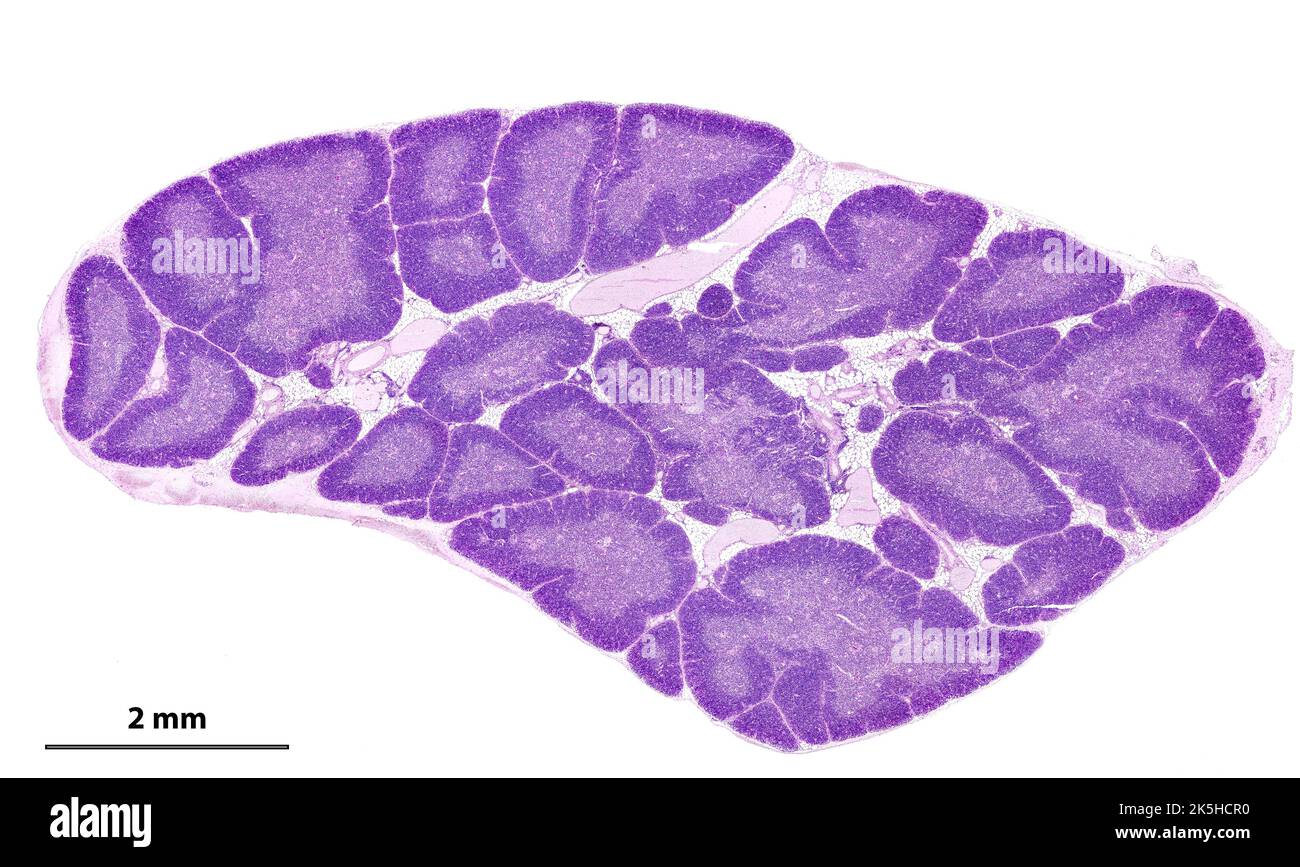 Low power light microscope micrograph of a human thymus gland stained with HE. The thymic parenchyma is composed of small lobules separated by adipose Stock Photo