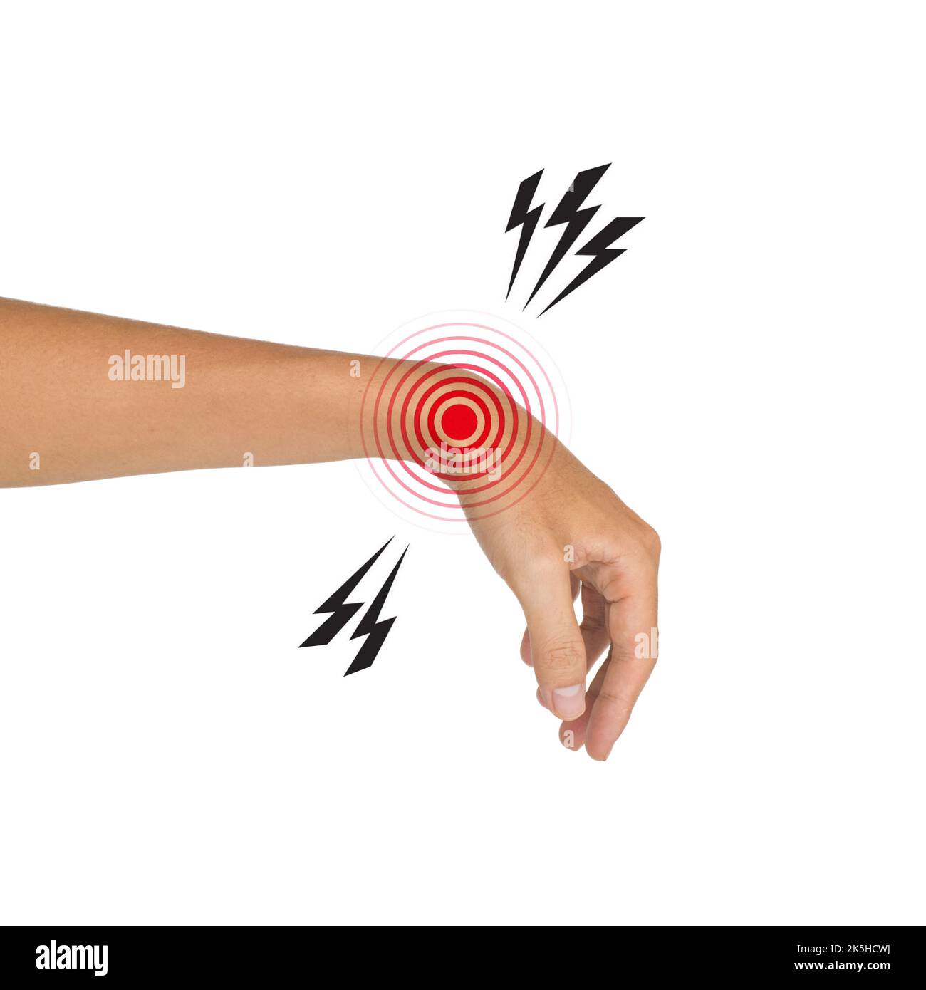 Swelling wrist hi-res stock photography and images - Alamy