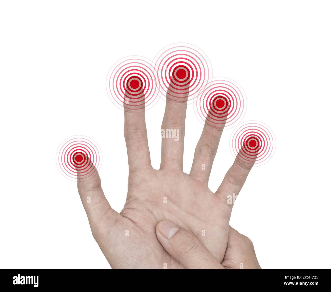 Tingling and numbness in fingertips of Asian young man with diabetes