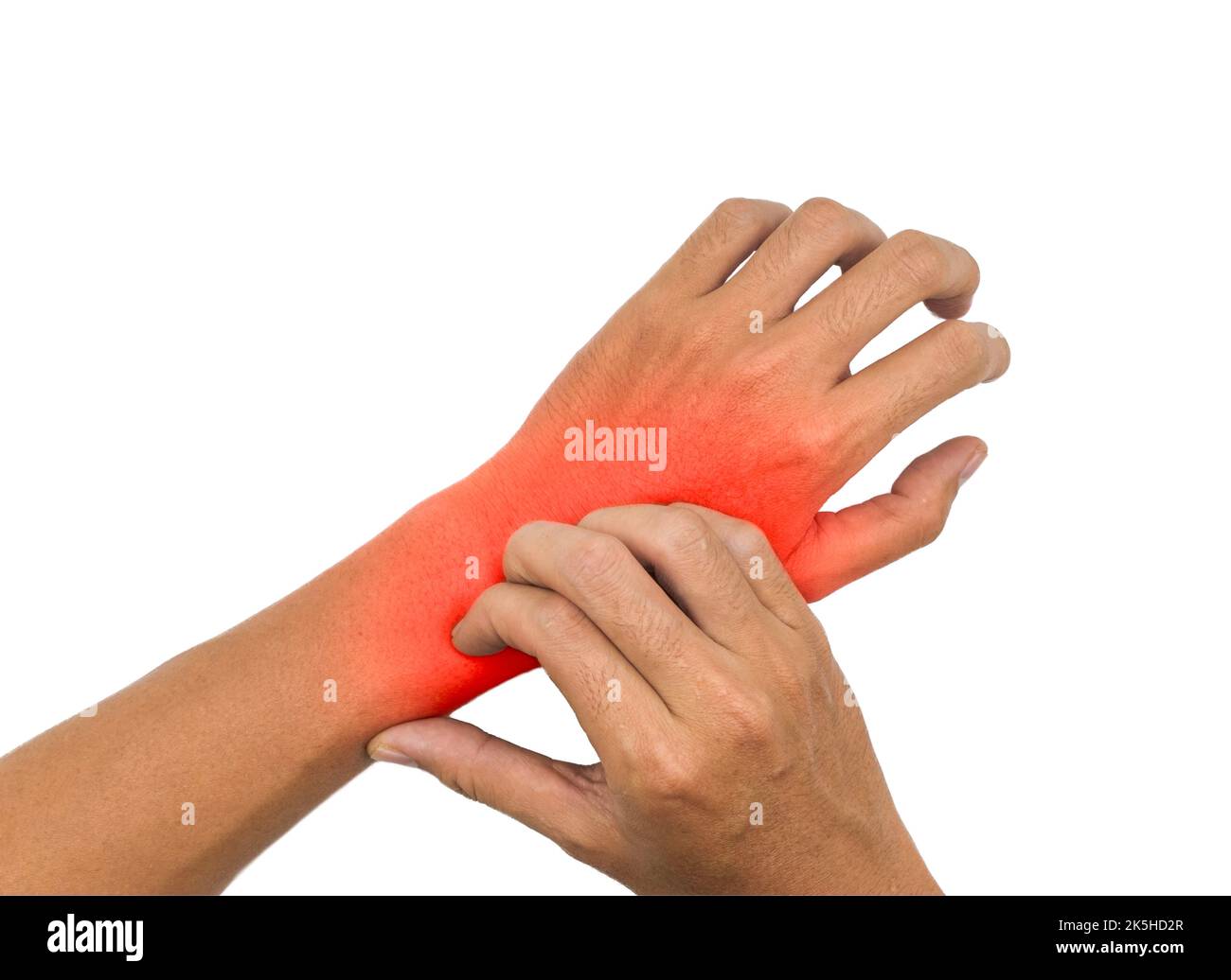 Asian young man scratching his hand. Concept of itchy skin diseases such as scabies, fungal infection, eczema, psoriasis, allergy, etc. Stock Photo