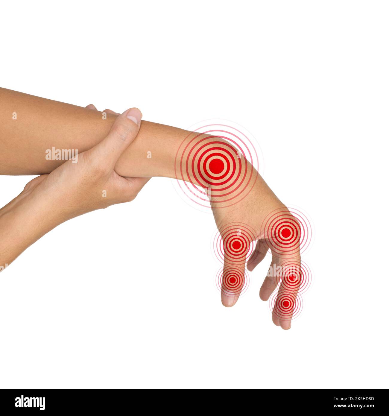 Multiple joints inflammation. Concept and idea of rheumatic arthritis, polyarthritis, hand joint swelling or arthralgia. Stock Photo